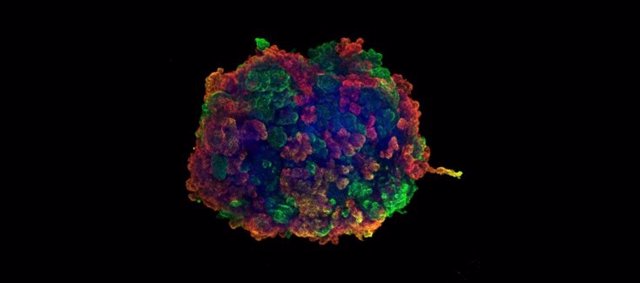 Identifican los genes que actúan como protectores contra las enfermedades renales