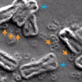 Foto: La ruptura de los cromosomas hace crecer a las células cancerosas