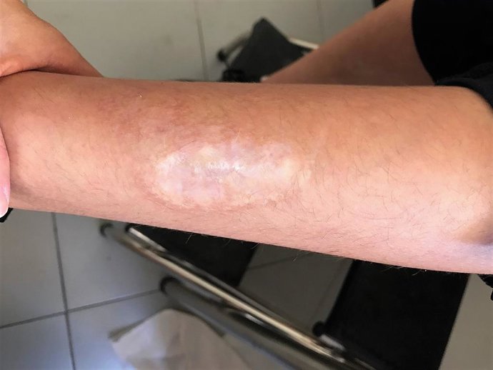 Caso clínico tratado en Granada sobre el 'reto de la ballena'