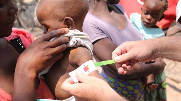 A un niño le miden el contorno del brazo en el Sur de África