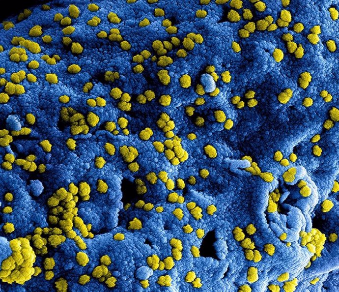 Micrografía electrónica de escaneo a color de las partículas del virus del Síndrome Respiratorio del Medio Oriente (MERS) adheridas a la superficie de una célula infectada.