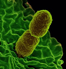 Micrografía electrónica de escaneo a color que muestra a la Klebsiella pneumoniae resistente al carbapenem interactuando con un neutrófilo humano