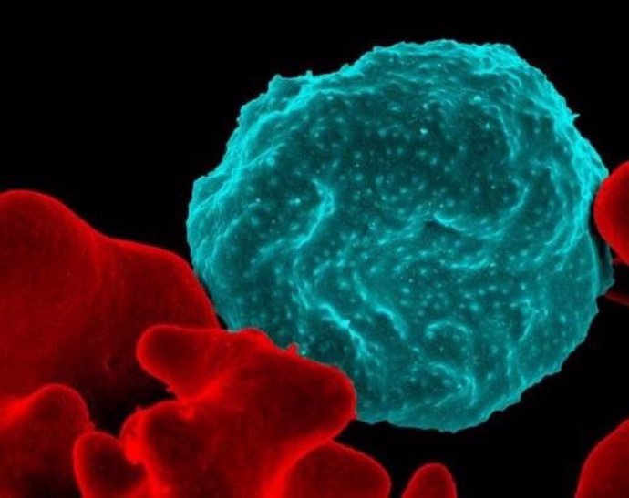 Imagen de glóbulos rojos infectados con malaria
