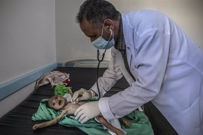Haifa es un bebé de 11 meses que sufre malnutrición. En la foto, está siendo atendido en el hospital Khalifa hospital de Taiz (Yemen) financiado por Save the Children.