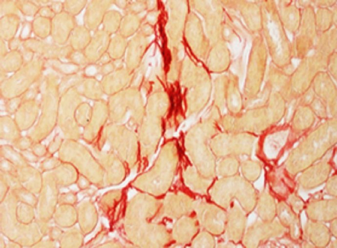 Sección del riñón de un ratón dañado por fibrosis.