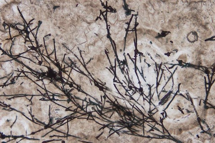 Imagen microscópica de microfósiles filamentosos parecidos a hongos