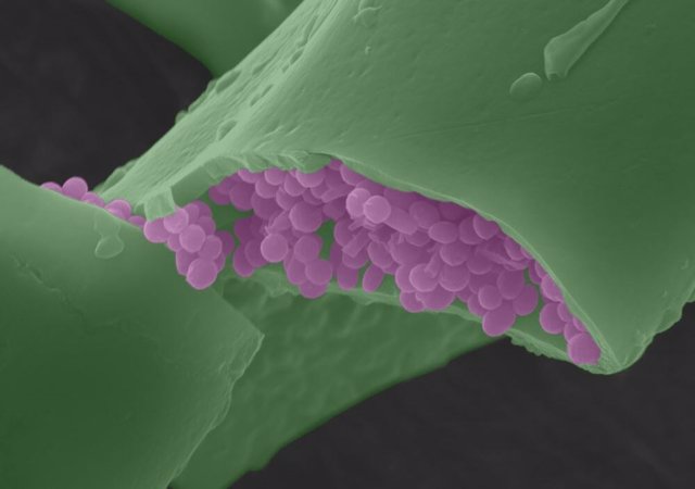Imagen de microscopio electrónico de barrido en falso color de melanosomas dentro de una púa de una pluma de pájaro moderna.