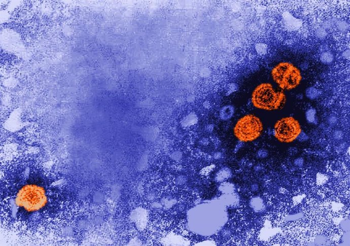 Imagen de microscopía electrónica de transmisión coloreada digitalmente revela la presencia de viriones de la hepatitis B (de color naranja).