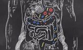 Foto: Investigan el uso de ciertas bacterias para prevenir la obesidad y el cáncer de colon