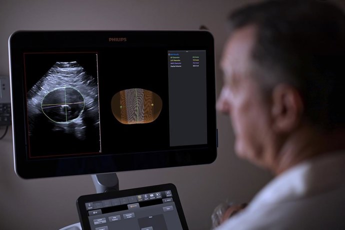 Modelo de aneurisma aórtico abdominal (AAA) de Philips