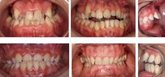 Foto: Experta asegura que la corrección de maloclusiones y malposiciones dentarias recupera la funcionalidad de la boca
