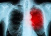 Foto: Los casos de insuficiencia cardíaca se disparan a nivel mundial