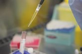 Foto: La Agencia Europea del Medicamento comienza a revisar la vacuna de CureVac contra el coronavirus