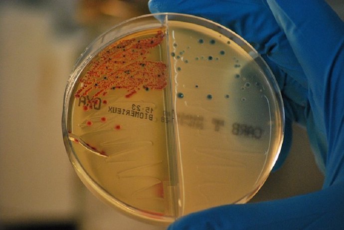 Bacterias resistentes a los antibióticos aisladas en el IRYCIS. /