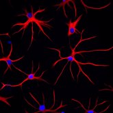 Foto: Las células cerebrales en forma de estrella pueden estar relacionadas con la tartamudez, según un estudio