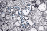 Foto: La mutación en la proteína clave del SARS-CoV-2 hace que el virus sea ocho veces más infeccioso