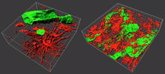 Foto: Una investigación de la UAB introduce el análisis de tumores con imágenes en 3D