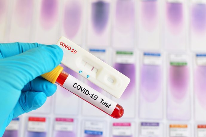Archivo - Pruebas del coronavirus, test Covid-19