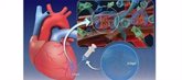 Foto: Investigadores españoles desarrollan un hidrogel capaz de regenerar el tejido cardíaco después de un infarto