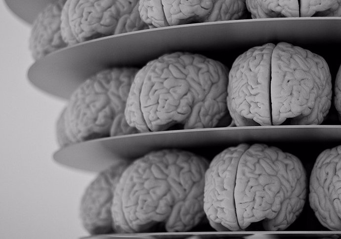 Archivo - Cerebro, Alzheimer.