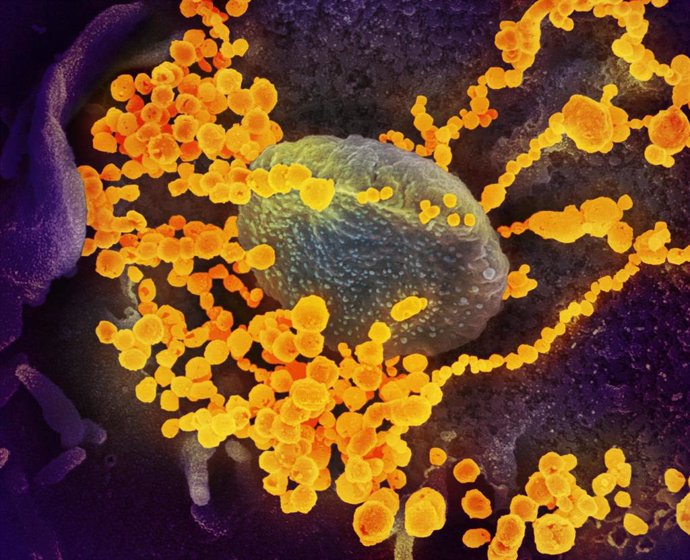 Archivo - Esta imagen de microscopio electrónico del Instituto estadounidense de Alergia y Enfermedades Infecciosas (NIAID), coloreada digitalmente, muestra el SARS-CoV-2.