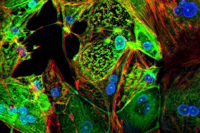 Esta imagen del tejido cardíaco diseñado muestra células de músculo cardíaco humano (rojo) infectadas con el SARS-CoV-2 (verde).