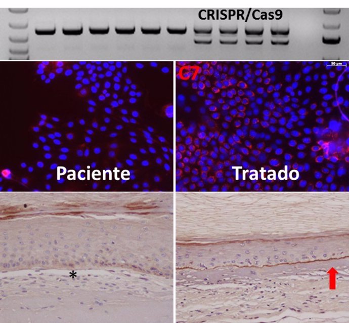 Imagen edicion epidermolisis