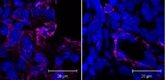 Foto: Una nueva terapia del CSIC utiliza nanopartículas contra la fibrosis pulmonar