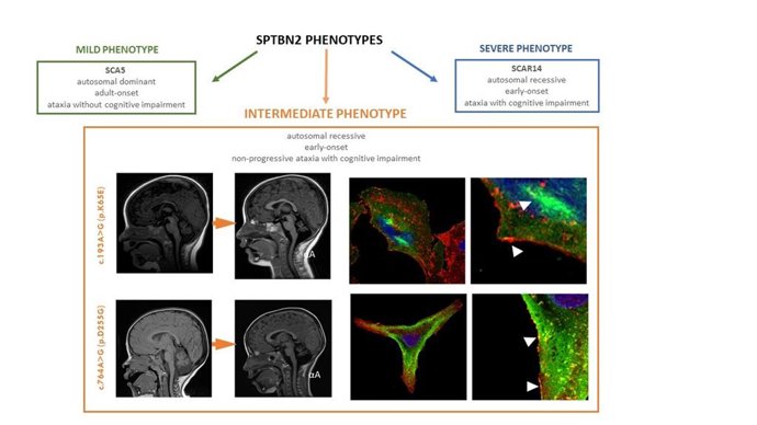 Gráfico de ataxia congénita