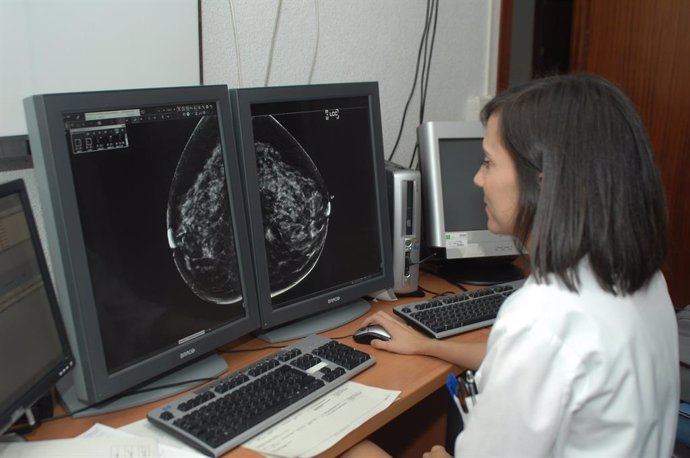 Archivo - Radiografía de una mamografía.