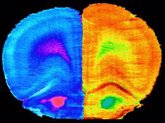 Foto: El deporte y el consumo de un nuevo probiótico mejoran la cognición de los enfermos hepáticos