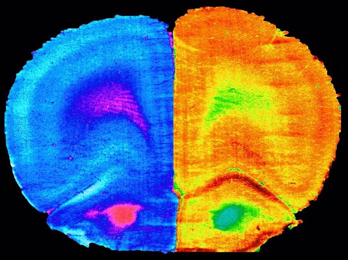 Corteza prefrontal de un ratón con la actividad cerebral reducida (izquierda) por una dieta alta en grasas frente a la recuperación con ejercicio o la administración de A. Muciniphila (derecha).