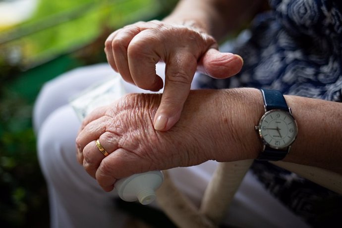 Archivo - Mujer mayor con artritis en la mano.