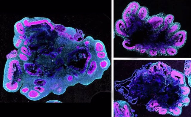 A las cinco semanas de edad, los organoides del cerebro humano (izquierda) son mucho más grandes que los de un gorila (arriba a la derecha) y un chimpancé (abajo a la derecha)