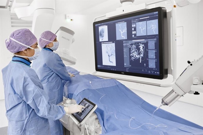 Archivo - Plataforma de terapia guiada por imágenes Azurion de Philips