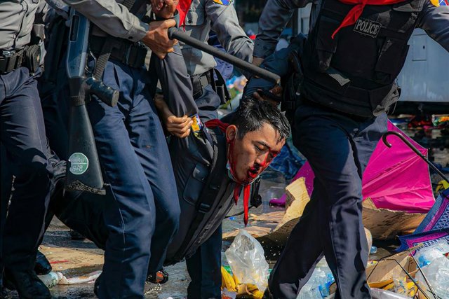 Archivo - Un hombre herido tras las cargas policiales en una protesta contra el Gobierno militar en Birmania.