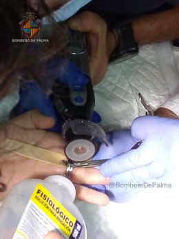Los Bomberos de Palma cortando el anillo de acero del joven.