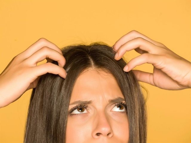 El cuero cabelludo graso es un problema estético más habitual de lo que pensamos