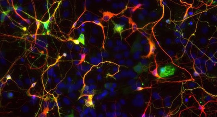 Archivo - Astrocitos talámicos reprogramados en neuronas in vitro tras la infección con un virus que induce la sobreexpresión del gen Neurogenin2.