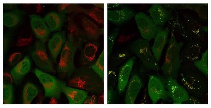 La proteína Parkin (señal verde) se encuentra en una parte diferente de la célula que las mitocondrias (señal roja) en el momento 0 (imagen izquierda), pero luego se co-localiza con las mitocondrias después de 60 minutos (imagen derecha).