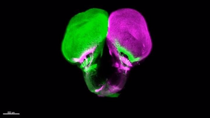 En esta imagen de microscopio, el hemisferio izquierdo del cerebro del pez gar se ilumina en verde y el derecho en magenta. Sin embargo, en la parte inferior de la imagen se pueden ver nervios de ambos colores que se conectan a ambos hemisferios.