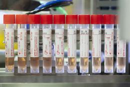 Copan UTM, the viral collection and transport medium recommended by the international guidelines for SARS-CoV-2 sampling (PRNewsfoto/Copan Italia SpA)
