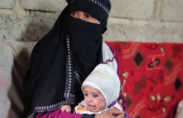 Archivo - Madre e hijo en Yemen
