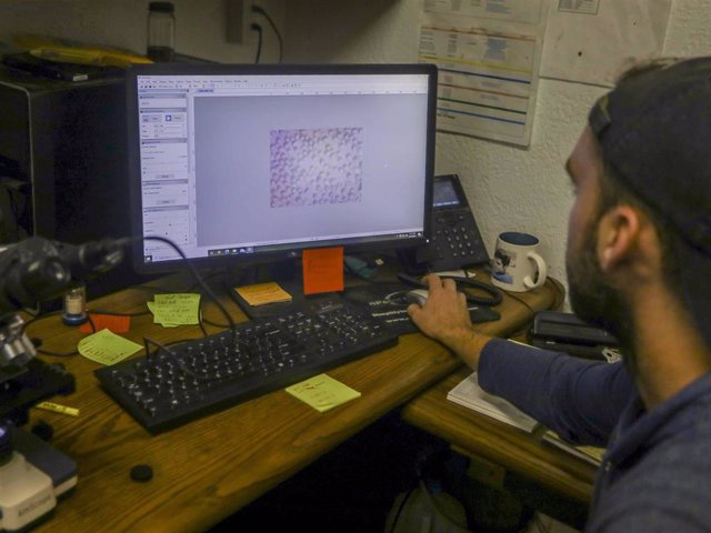Lab Technician Ian Reilly shows a scan of a Sangria sample on his computer while he checks for yeast viability at Keel Farms in Plant City on Friday