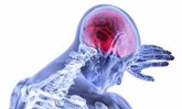 Foto: Las lesiones cerebrales traumáticas pueden aumentar el riesgo de ictus hasta cinco años