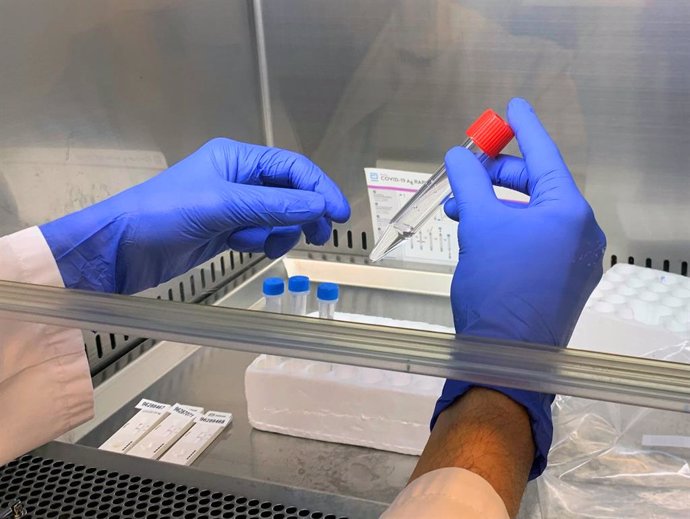 Archivo - PCR con muestra en saliva para detección de Covid-19