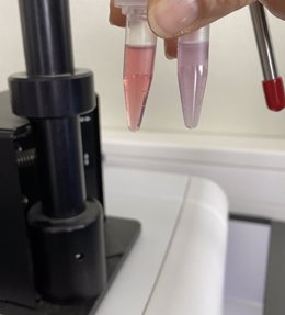 Imagen del ensayo del Método para determinar la presencia y/o estadio de tumores malignos mediante una muestra de orina.