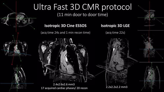 Visualización 3D de los estudios de anatomía, función y caracterización tisular adquiridos con el protocolo utra-rápido.