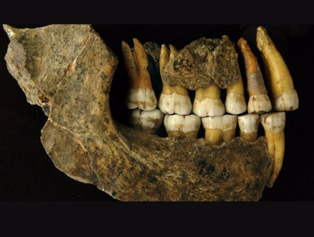 Archivo - Mandíbula neandertal
