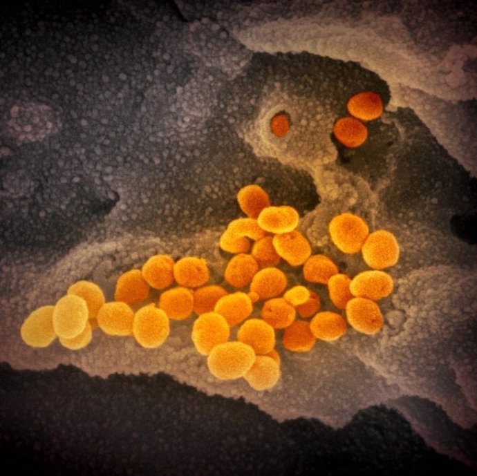 Esta imagen de microscopio electrónico de barrido muestra el SARS-CoV-2 (naranja), el virus que causa la COVID-19, aislado de un paciente en EE.UU. El virus emerge de la superficie de las células (gris) cultivadas en el laboratorio.